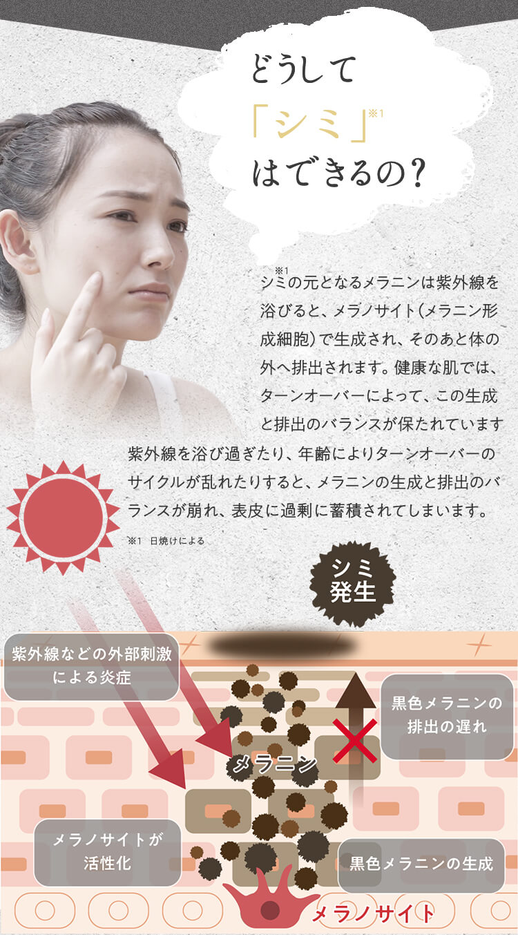 どうしてシミはできるの？